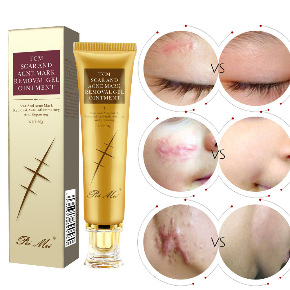 Silicone Scar Gel For Skin Repair And Scar Reduction