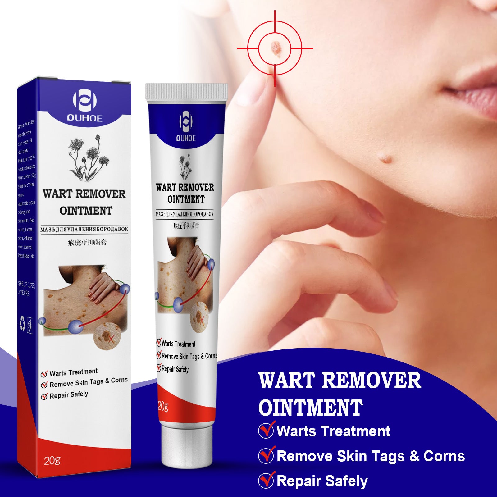 Furuanping Cream Corns Removing Filiform Skin Care