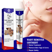 Furuanping Cream Corns Removing Filiform Skin Care