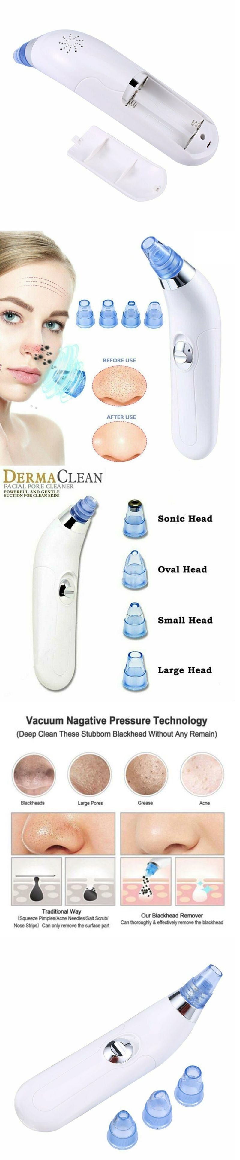 Ultrasonic Vibration Blackhead Suction Cleaner – Deep Pore Facial Cleanser