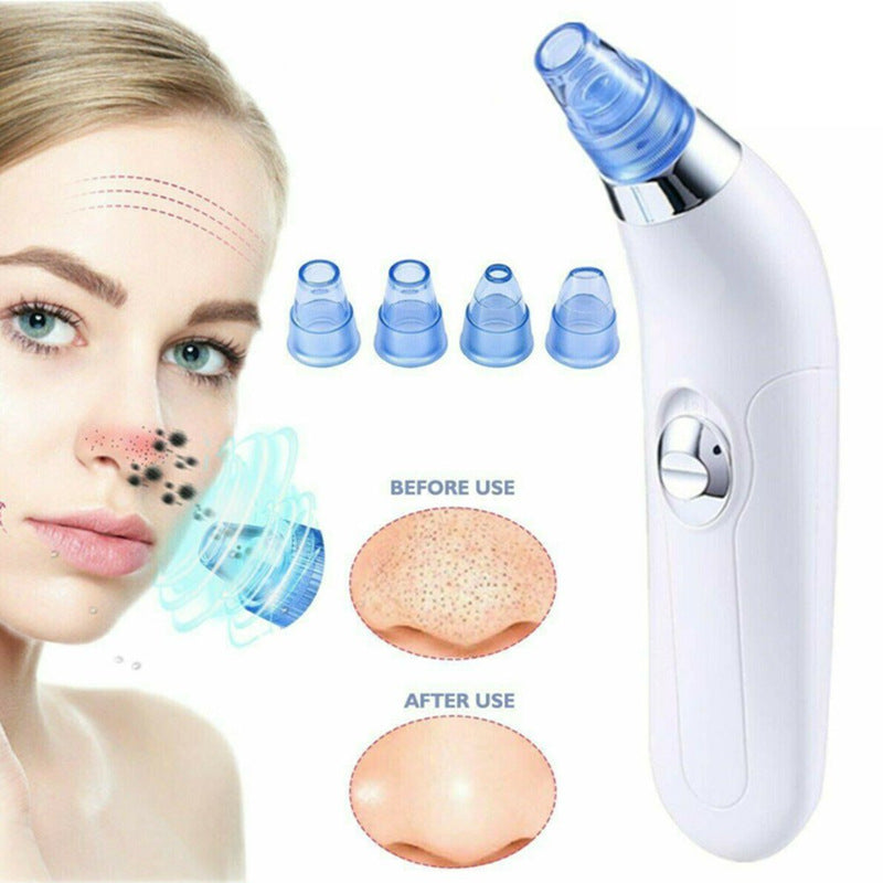 Ultrasonic Vibration Blackhead Suction Cleaner – Deep Pore Facial Cleanser