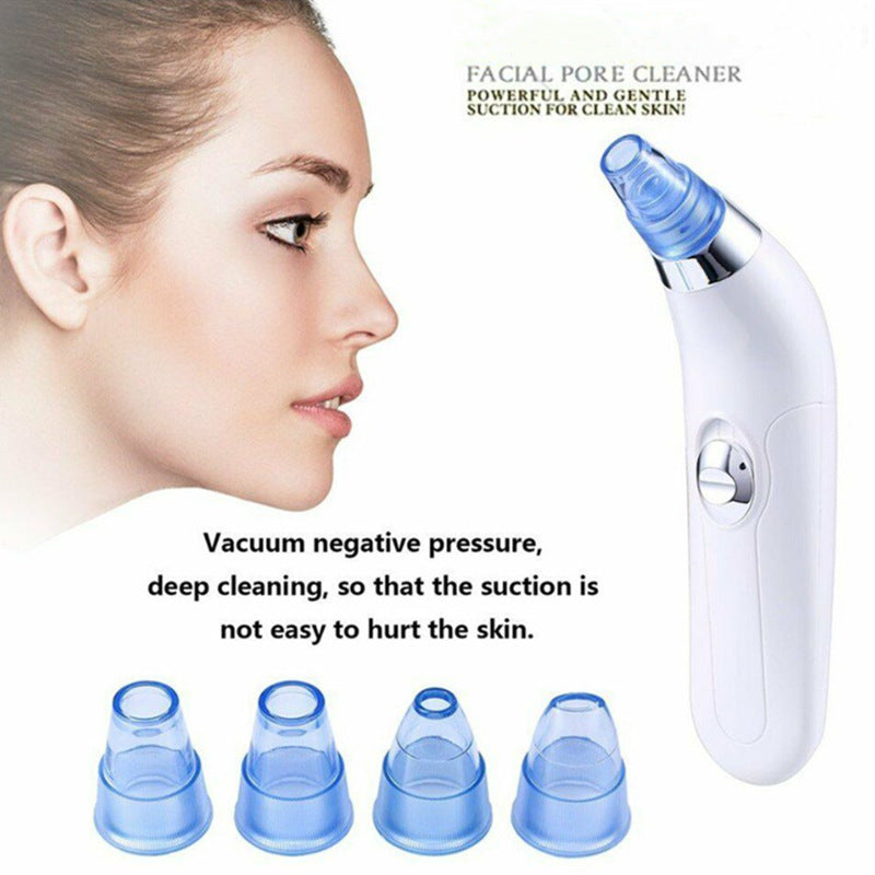 Ultrasonic Vibration Blackhead Suction Cleaner – Deep Pore Facial Cleanser