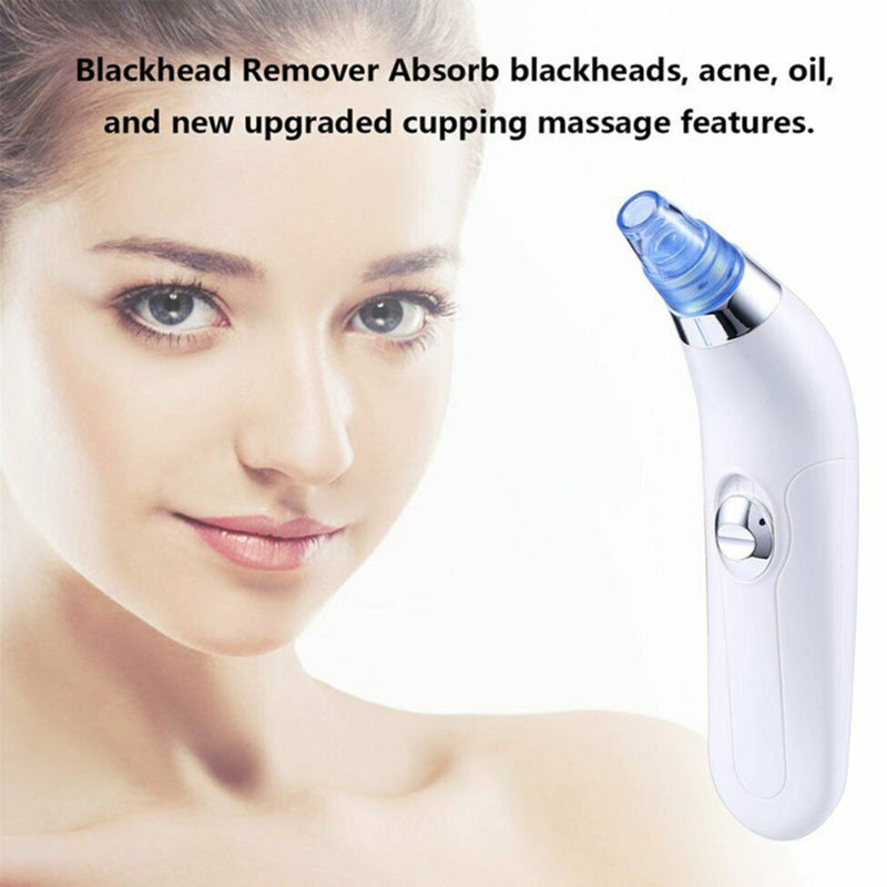 Ultrasonic Vibration Blackhead Suction Cleaner – Deep Pore Facial Cleanser