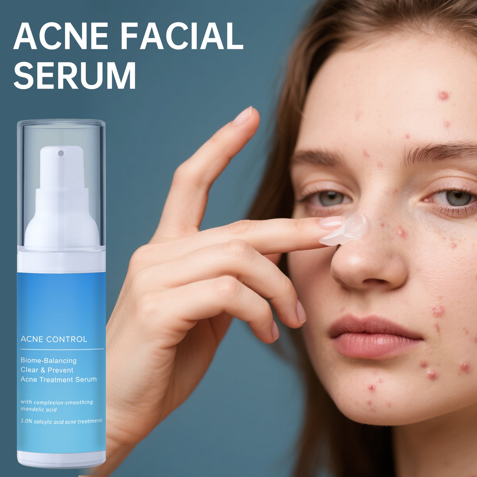 Salicylic Acid Cleansing And Conditioning Acne Mite Balance Water And Oil Fade Smoothing Pockmark Itching Facial Essence