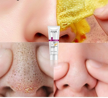 Gold and Black Peel Off Face Mask for Deep Cleansing and Glow