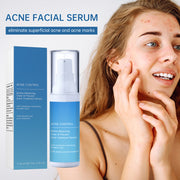 Salicylic Acid Cleansing And Conditioning Acne Mite Balance Water And Oil Fade Smoothing Pockmark Itching Facial Essence
