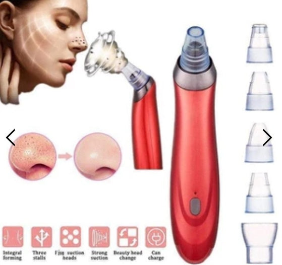 Electric Blackhead Remover – Pore Vacuum Cleaner Acne Extractor Tool