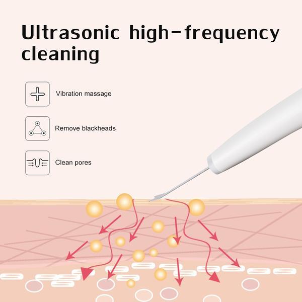 Ultrasonic Skin Scrubber Facial Cleaner for Deep Cleansing and Exfoliation