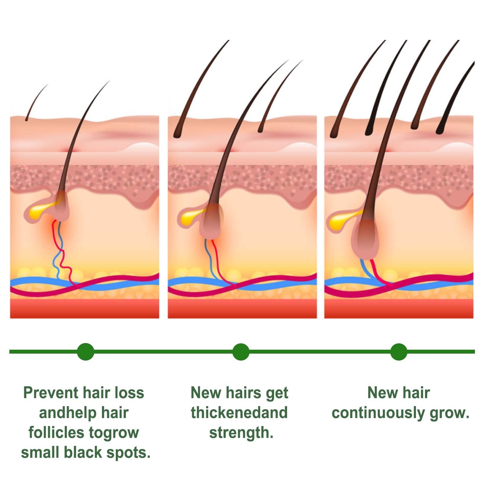 Rosemary Hair Care Capsules Nourish Hair Roots And Prevent Hair Loss