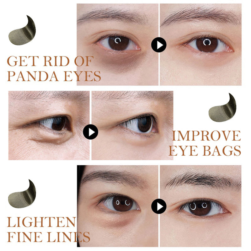 Black Pearl Eye Mask – Moisturizing Treatment for Dark Circles, Fine Lines & Eye Bags