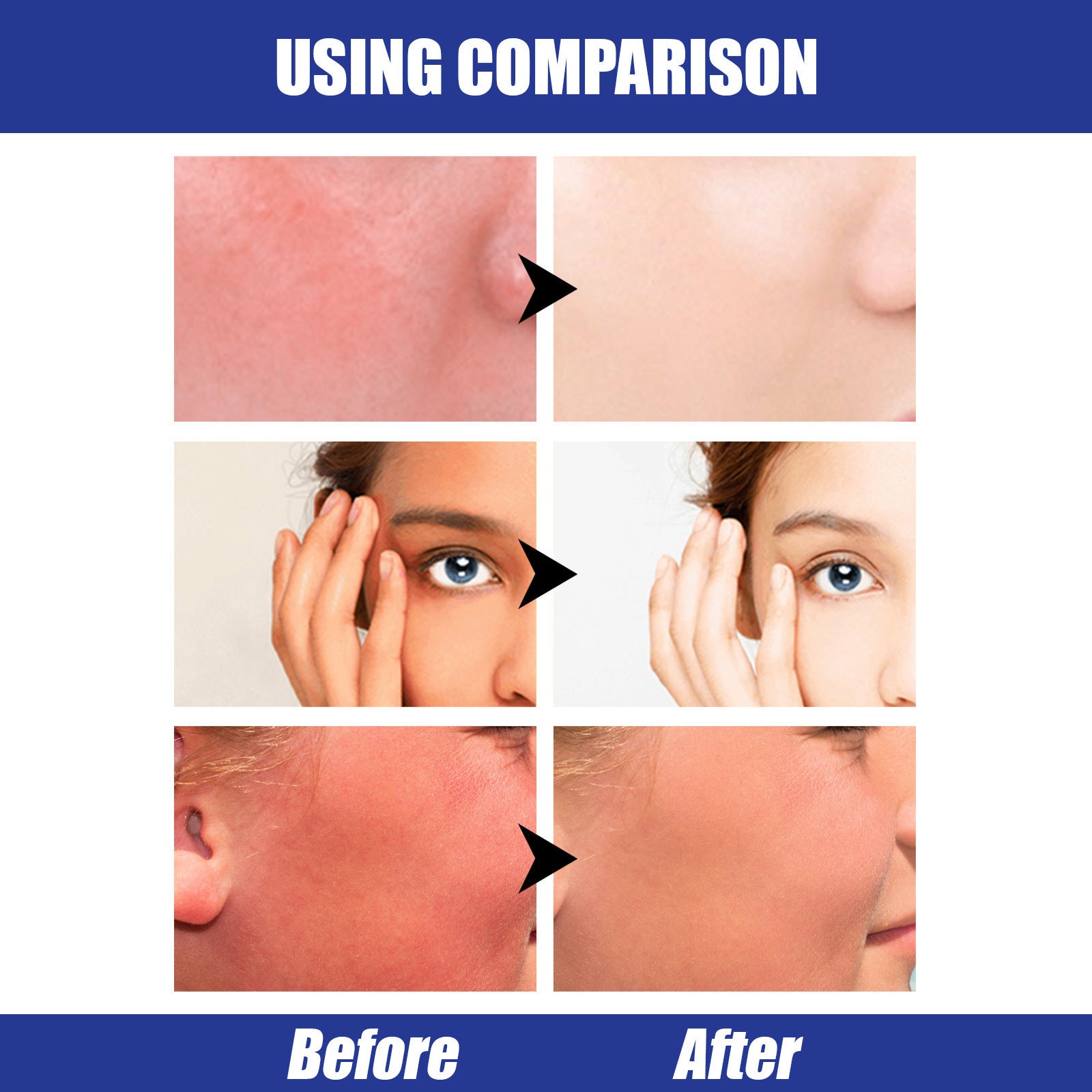 Hyaluronic Acid Sunscreen Stick SPF50 With Titanium Dioxide
