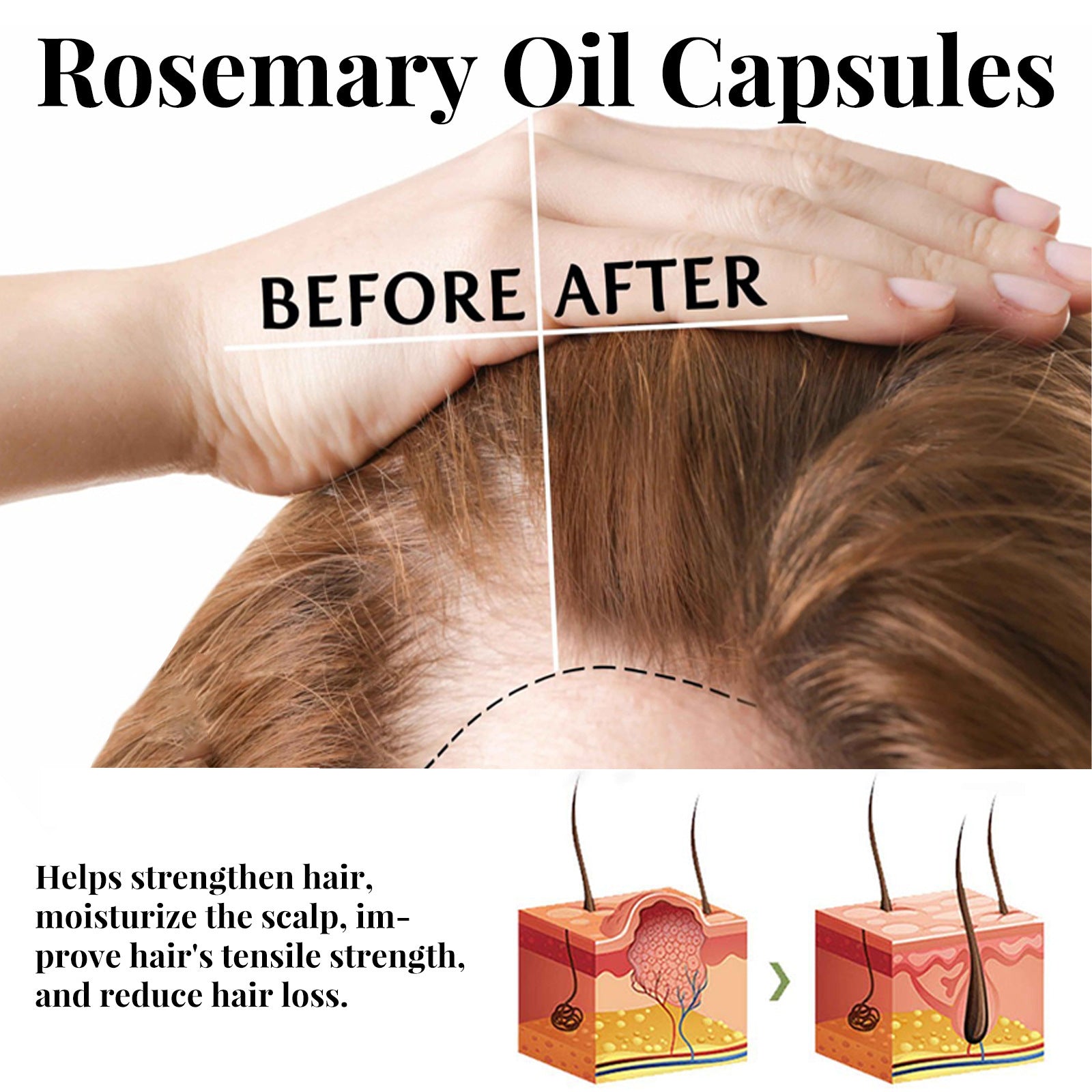 Rosemary Hair Care Capsules Nourish Hair Roots And Prevent Hair Loss