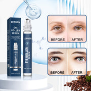 Skin Around The Eyes Moisturizing Lifting Firming And Reducing Fine Lines Eye Essence