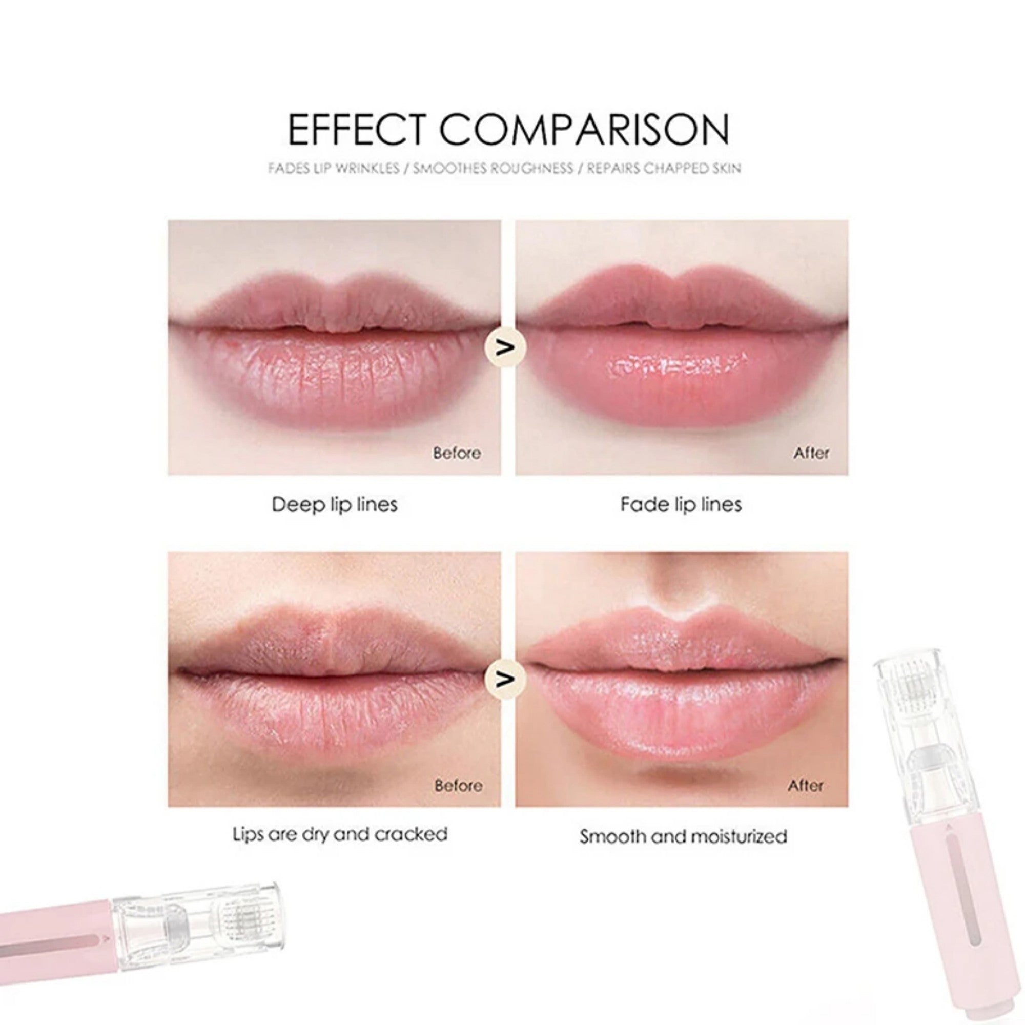 3-in-1 Lip Care Roller – Beard Growth Roller, Needle Roller & Serum Applicator for Hair Growth