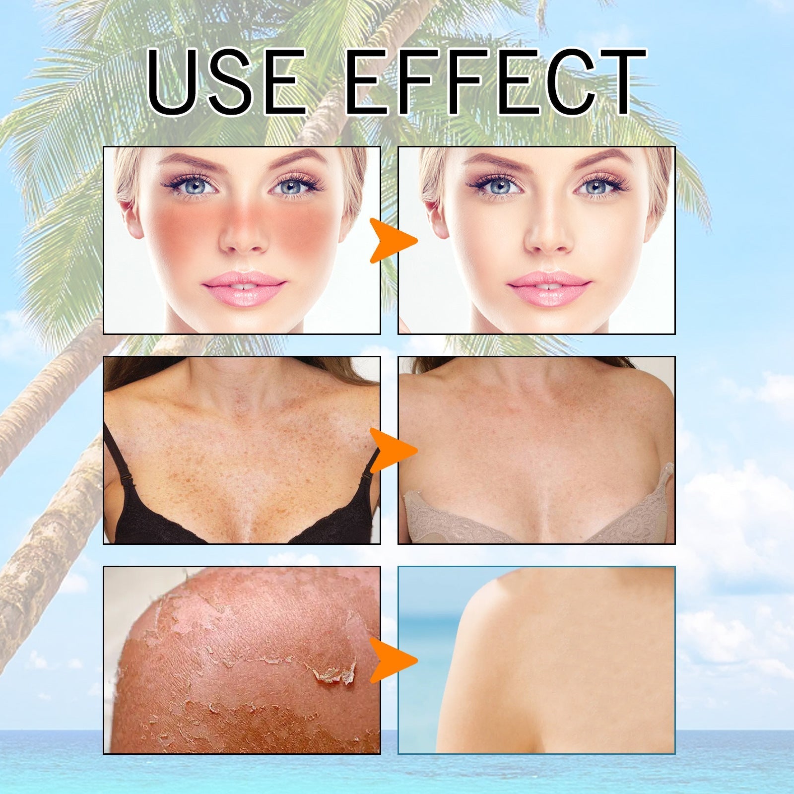 Hyaluronic Acid Gel Sunscreen For Summer UV Protection