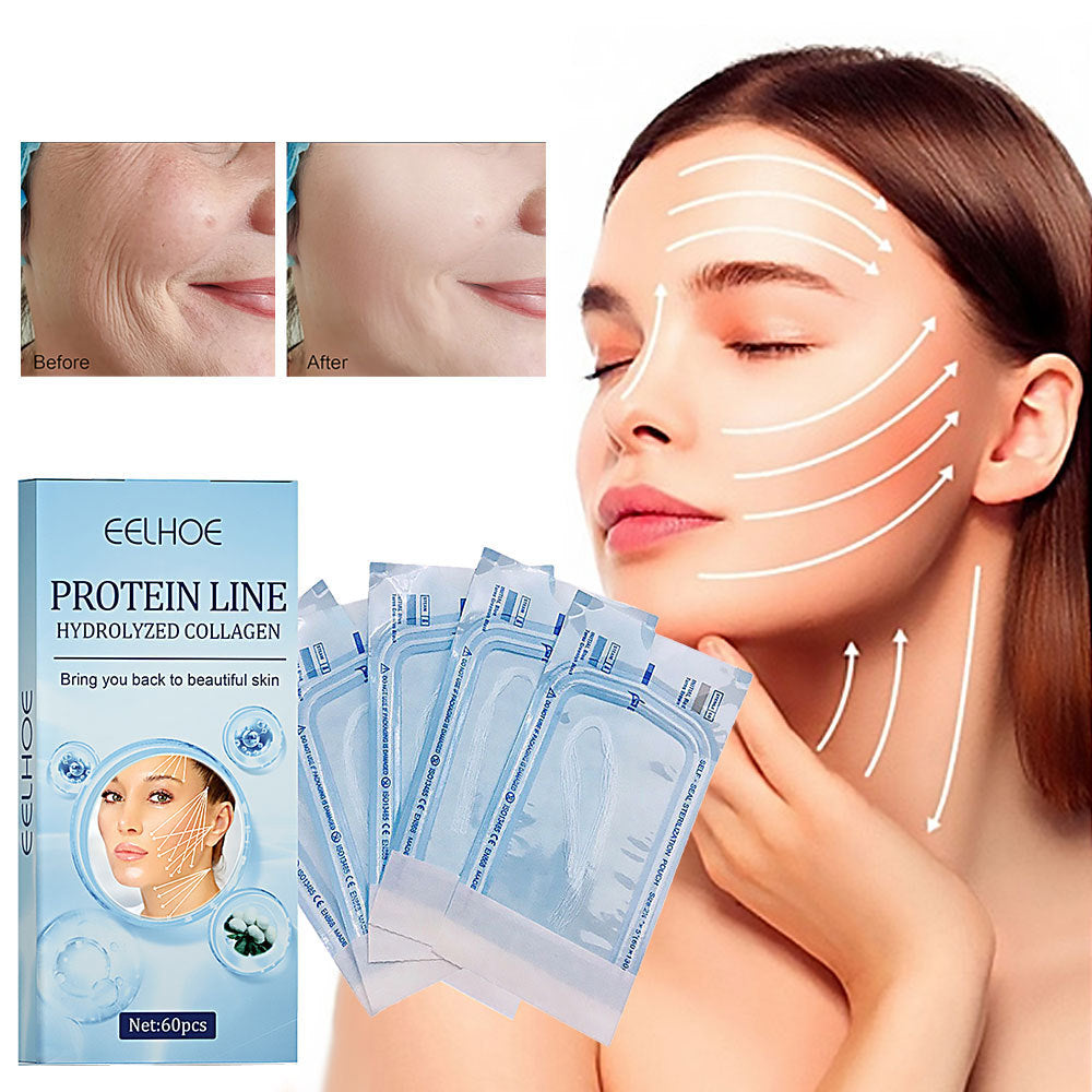 Protein Lifting Line – V-Face Anti-Wrinkle Skin Tightening Thread