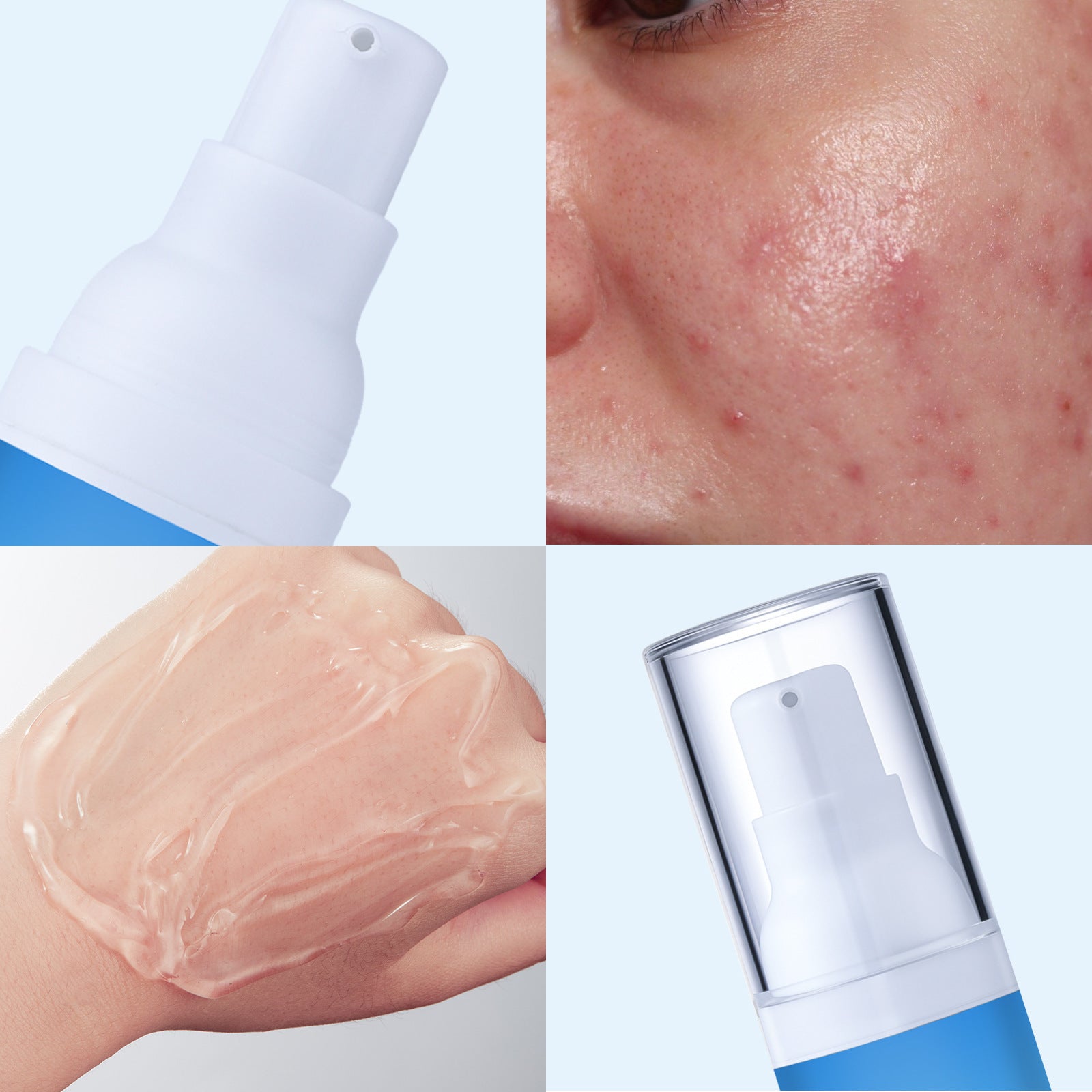 Salicylic Acid Cleansing And Conditioning Acne Mite Balance Water And Oil Fade Smoothing Pockmark Itching Facial Essence